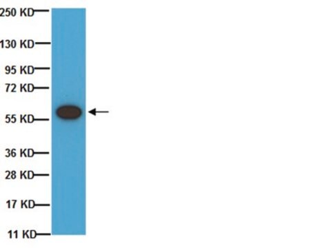 Anti-Tyrosinhydroxylase-Antikörper, phosphoSer&nbsp;40 Chemicon&#174;, from rabbit