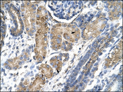 Anti-SNAI2 antibody produced in rabbit affinity isolated antibody