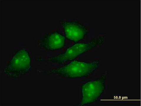 Anti-METTL2 antibody produced in mouse purified immunoglobulin, buffered aqueous solution