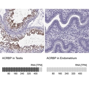 Anti-ACRBP antibody produced in rabbit Prestige Antibodies&#174; Powered by Atlas Antibodies, affinity isolated antibody, buffered aqueous glycerol solution