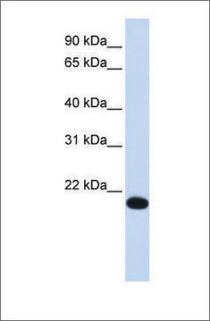 Anti-YAF2 antibody produced in rabbit affinity isolated antibody