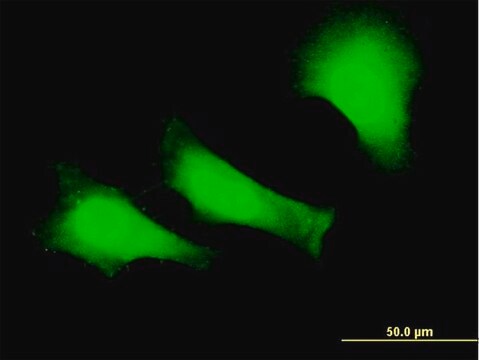 Monoclonal Anti-FANCC antibody produced in mouse clone 6E7, purified immunoglobulin, buffered aqueous solution