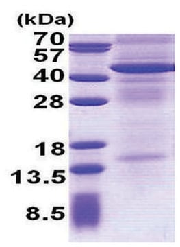 IL13RA2 human recombinant, expressed in E. coli, &#8805;85% (SDS-PAGE)