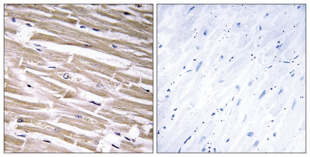 Anti-B3GALT2 antibody produced in rabbit affinity isolated antibody