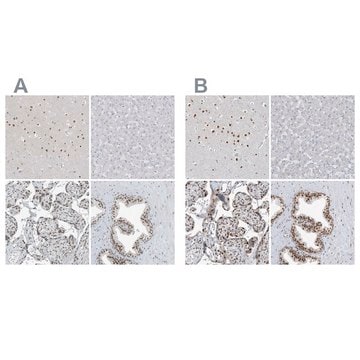 Anti-WRNIP1 antibody produced in rabbit Prestige Antibodies&#174; Powered by Atlas Antibodies, affinity isolated antibody, buffered aqueous glycerol solution