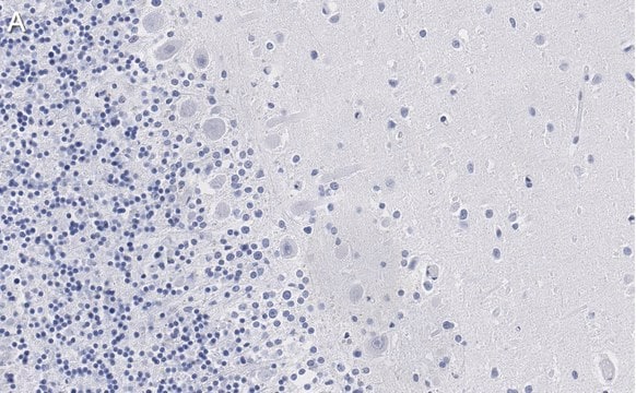 Anti-Aldolase C Antibody, clone 3B18, ZooMAb&#174; Rabbit Monoclonal recombinant, expressed in HEK 293 cells