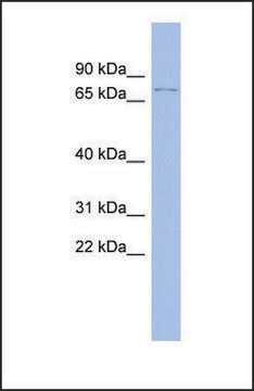 Anti-TP73 antibody produced in rabbit affinity isolated antibody