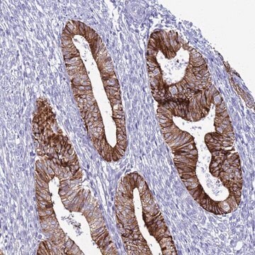 Anti-ABHD17B antibody produced in rabbit Prestige Antibodies&#174; Powered by Atlas Antibodies, affinity isolated antibody, buffered aqueous glycerol solution