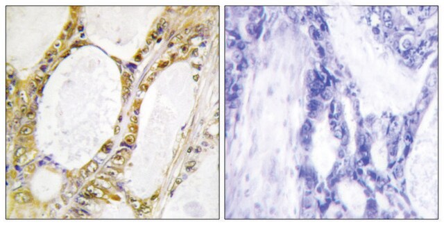 Anti-IRF2 antibody produced in rabbit affinity isolated antibody