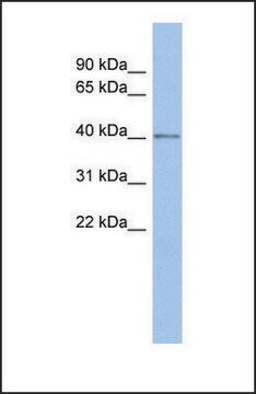 Anti-SPOPL antibody produced in rabbit affinity isolated antibody