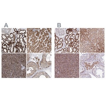 Anti-SUCLG2 antibody produced in rabbit Prestige Antibodies&#174; Powered by Atlas Antibodies, affinity isolated antibody, buffered aqueous glycerol solution