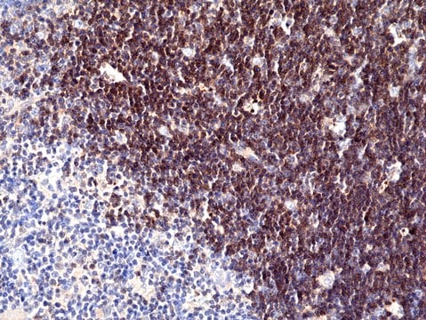 Anti-CD1a Rabbit Monoclonal Antibody clone RM393, affinity purified immunoglobulin