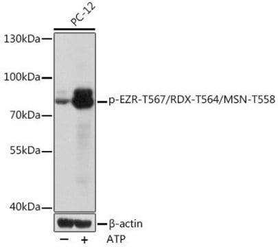 Anti-Phospho-EZR-T567/RDX-T564/MSN-T558 antibody produced in rabbit