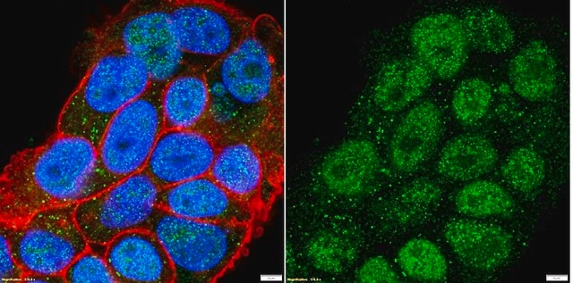 Anti-Estrogen Receptor &#945; Antibody from rabbit, purified by affinity chromatography