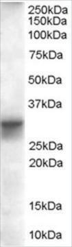 Anti-SLIMMER/FHL1 Isoform B antibody produced in goat affinity isolated antibody, buffered aqueous solution