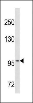 ANTI-OTUD7A (N-TERM) antibody produced in rabbit IgG fraction of antiserum, buffered aqueous solution