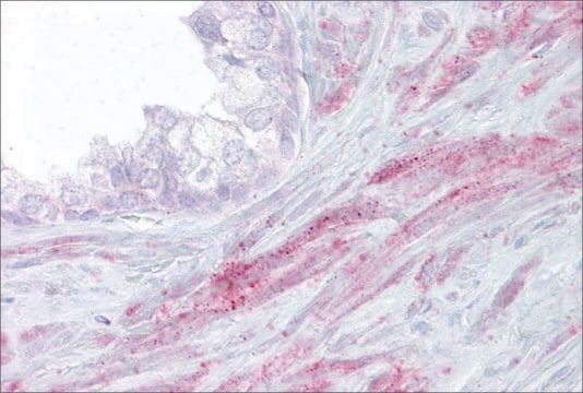 Anti-TRPM8, (N-terminal) antibody produced in rabbit affinity isolated antibody