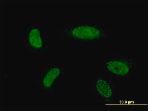 ANTI-ATOH1 antibody produced in mouse clone 3B12, purified immunoglobulin, buffered aqueous solution