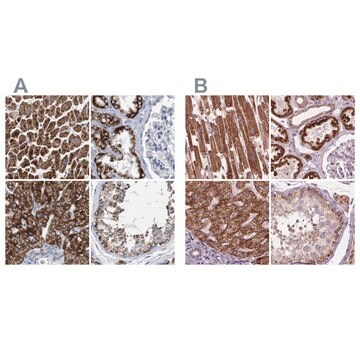 Anti-ECI2 antibody produced in rabbit Prestige Antibodies&#174; Powered by Atlas Antibodies, affinity isolated antibody, buffered aqueous glycerol solution