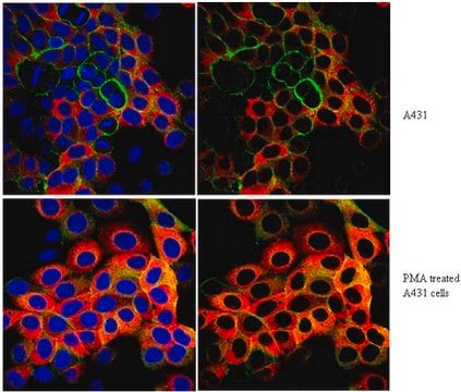 Anti-phospho-Ribosomal Protein S6 Antibody (Ser240/Ser244) from rabbit, purified by affinity chromatography