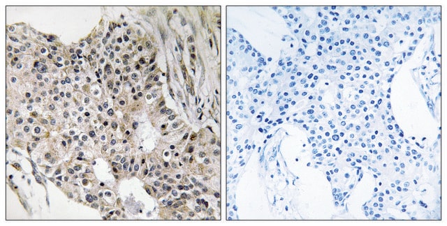 Anti-UEVLD antibody produced in rabbit affinity isolated antibody