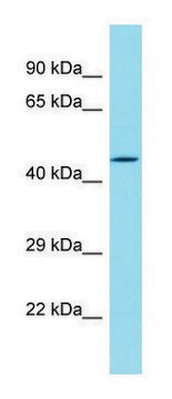 Anti-DBF4B (N-terminal) antibody produced in rabbit affinity isolated antibody