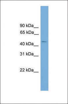 Anti-C11ORF16 antibody produced in rabbit affinity isolated antibody