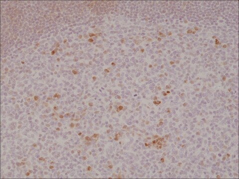 Anti-OX40 (CD134) antibody, Rabbit monoclonal recombinant, expressed in HEK 293 cells, clone RM313, purified immunoglobulin