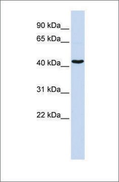 Anti-GATA1 antibody produced in rabbit affinity isolated antibody