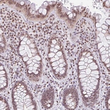 Anti-NOL6 antibody produced in rabbit Prestige Antibodies&#174; Powered by Atlas Antibodies, affinity isolated antibody, buffered aqueous glycerol solution