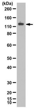 Anti-phospho-VE-Cadherin (Tyr685) from rabbit, purified by affinity chromatography