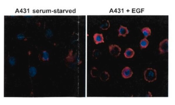 Anti-Phosphotyrosine, clone RM111 Antibody clone RM111, from rabbit, purified by affinity chromatography