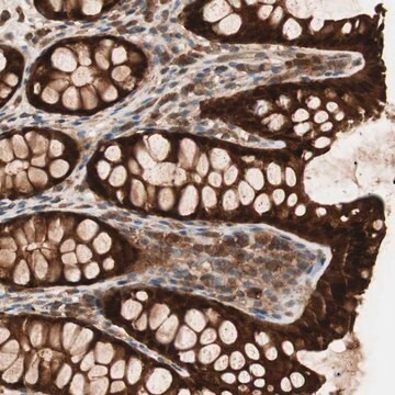 Anti-GALE antibody produced in rabbit Prestige Antibodies&#174; Powered by Atlas Antibodies, affinity isolated antibody, buffered aqueous glycerol solution