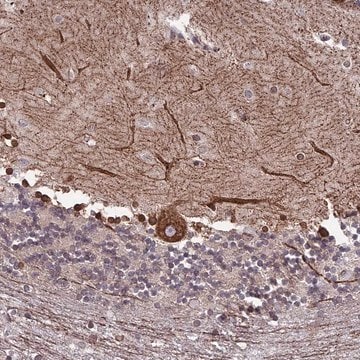 Anti-PTCHD4 antibody produced in rabbit Prestige Antibodies&#174; Powered by Atlas Antibodies, affinity isolated antibody, buffered aqueous glycerol solution