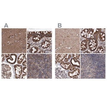 Anti-SUCLA2 antibody produced in rabbit Prestige Antibodies&#174; Powered by Atlas Antibodies, affinity isolated antibody