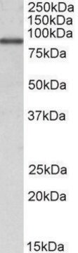 Anti-ALDH18A1 (C-terminal) antibody produced in goat affinity isolated antibody, buffered aqueous solution