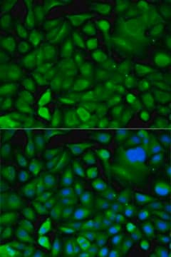 Anti-MIF antibody produced in rabbit