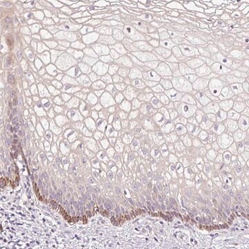 Anti-FUT10 antibody produced in rabbit Prestige Antibodies&#174; Powered by Atlas Antibodies, affinity isolated antibody, buffered aqueous glycerol solution