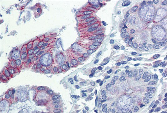 Anti-DSG2 antibody produced in rabbit affinity isolated antibody