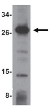 Anti-OCIAD1 Antibody from rabbit, purified by affinity chromatography