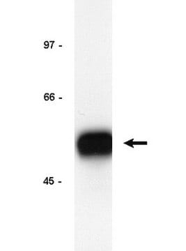 Anticuerpo anti-E2F-1, clones KH20 y KH95 Upstate&#174;, from mouse