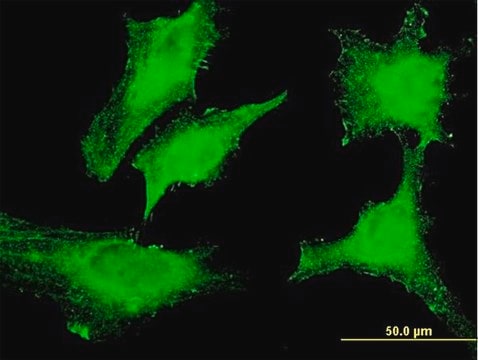 Monoclonal Anti-RASD1 antibody produced in mouse clone 2D12, purified immunoglobulin, buffered aqueous solution