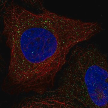 Anti-WBSCR28 antibody produced in rabbit Prestige Antibodies&#174; Powered by Atlas Antibodies, affinity isolated antibody