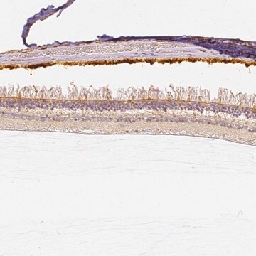 Anti-CNGB3 antibody produced in rabbit Prestige Antibodies&#174; Powered by Atlas Antibodies, affinity isolated antibody