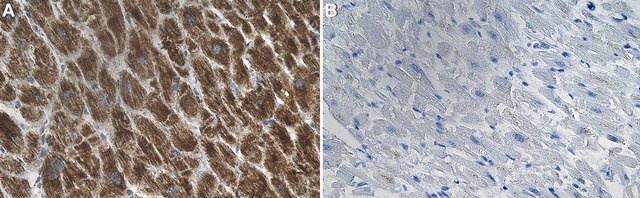 Anti-ATP5A1 Antibody, clone 1J7 ZooMAb&#174; Rabbit Monoclonal recombinant, expressed in HEK 293 cells