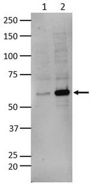 Anti-Dyskerin (Sheep) from sheep, purified by affinity chromatography