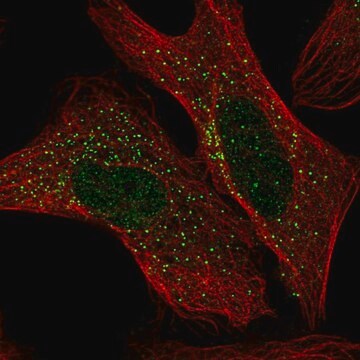 Anti-ADAM32 antibody produced in rabbit Prestige Antibodies&#174; Powered by Atlas Antibodies, affinity isolated antibody