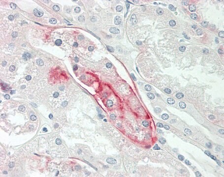 Anti-SLC44A2 antibody produced in rabbit affinity isolated antibody