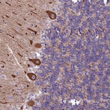 Anti-SMPD4 antibody produced in rabbit Prestige Antibodies&#174; Powered by Atlas Antibodies, affinity isolated antibody, buffered aqueous glycerol solution