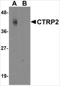 Anti-CTRP2 (ab2) antibody produced in rabbit affinity isolated antibody, buffered aqueous solution